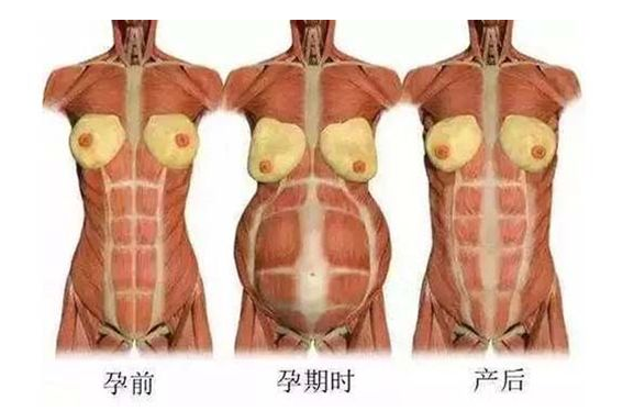產(chǎn)后媽媽骨盆修復(fù)――帶你回到完美身材！