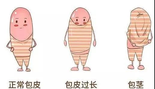 【保山安利醫(yī)院】家長速看！暑期包皮手術(shù)預(yù)約正當(dāng)時！