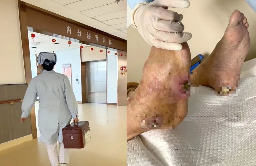 【保山安利醫(yī)院】傷口治療一站式，健康生活零距離！